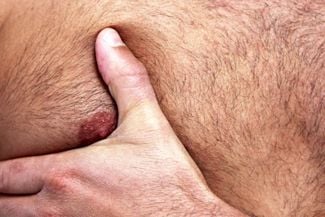 Why Do Men Have Nipples?
