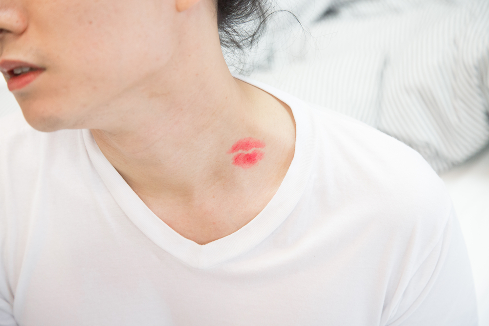 20 Tested Tips For How to Get Rid of a Hickey - The Habitat